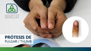 Prótesis de Pulgar DIANCEHT | Thumb Prosthesis No.275