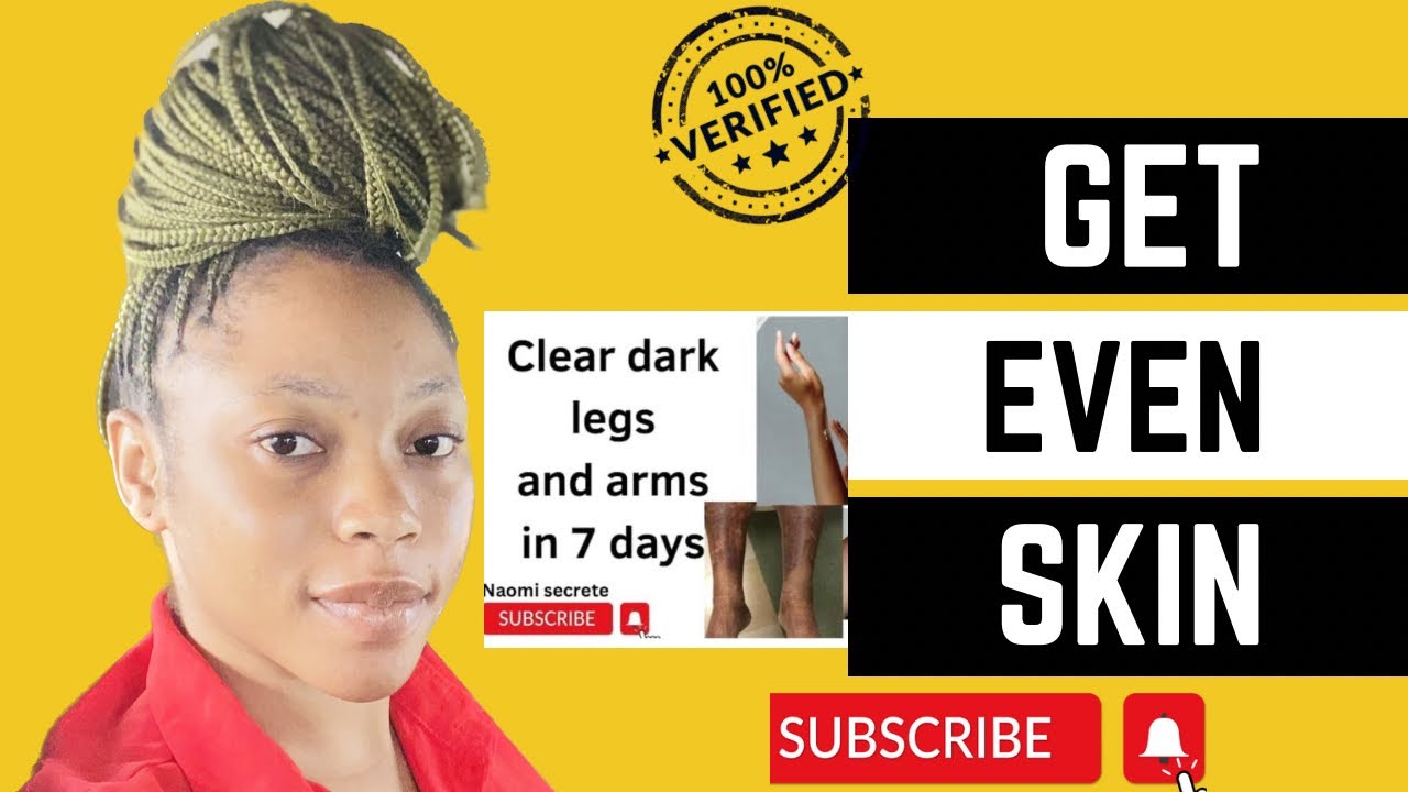 How to lighten Dark Legs and Arms in few Days 