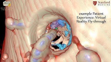 Stanford Neurosurgery Virtual Reality Lab