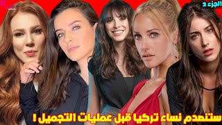 شكل نساء تركيا قبل عمليات التجميل ستنصدم /الجزء2