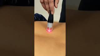 Back Pain Laser Treatment shorts rehabilitation chiropractor backpain physiotherapy lowbackpai