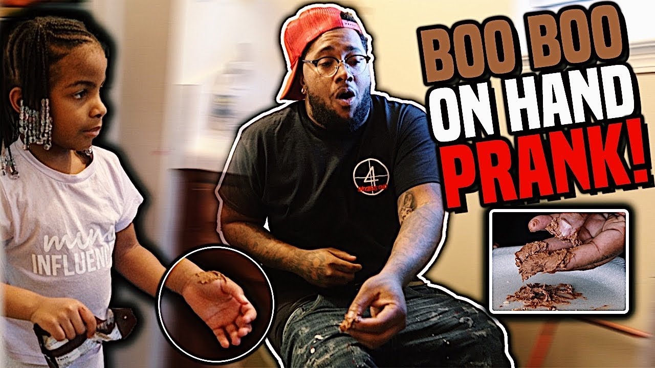 Boo Boo On Hand Prank Youtube
