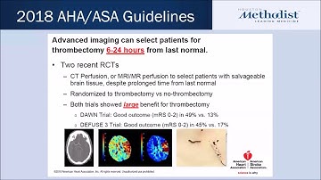 Triage of Acute Stroke using Perfusion Processing for Thrombectomy Selection: RAPID & other options