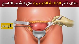 متى تتم الولادة القيصرية في الشهر التاسع ؟