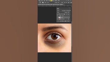 😦 கருவளையம் - Dark Circles
