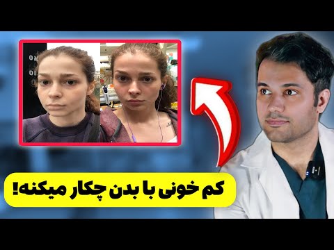 علایم کم خونی فقر آهن درمان کم خونی پیشگیری