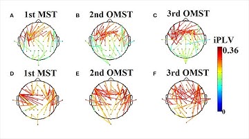 Orthogonalized Minimum Spanning Tree and their application for Human Brain Mapping | Paper Review