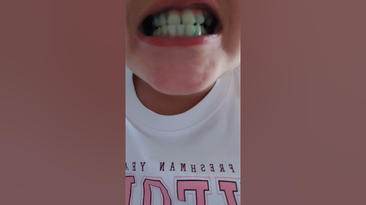 pov:io quando metto glim&m in bocca🤣🤣