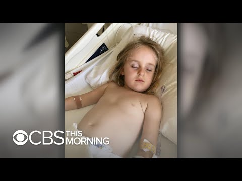 Unusual number of Minnesota children diagnosed with rare acute flaccid myelitis