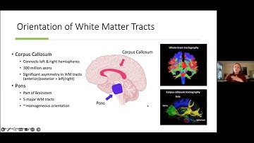 Cariad Knight - Can 31P ssNMR Take Center Stage in Quantitative MRI of Membrane Morphology?