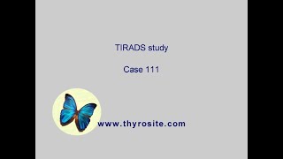 Study on TIRADS - case 111