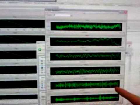 EEG Blink Detection