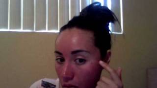 Acne treatment Levulan: Day 1
