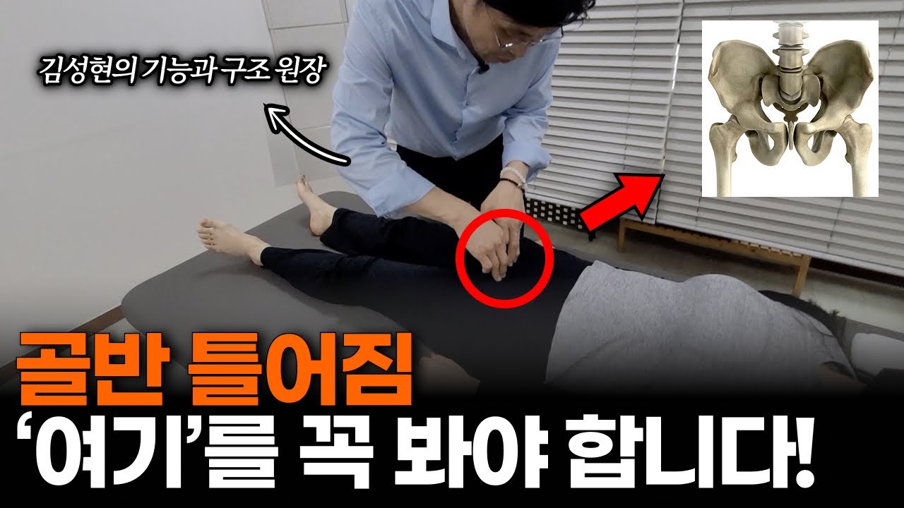 골반의 모습을 왜곡되게 만드는 치골교정 - YouTube