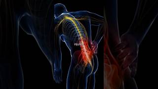 Stop! Wrong Yoga Alignment Can Cause Pain #yoga #shorts #youtube #wrongyoga #viral