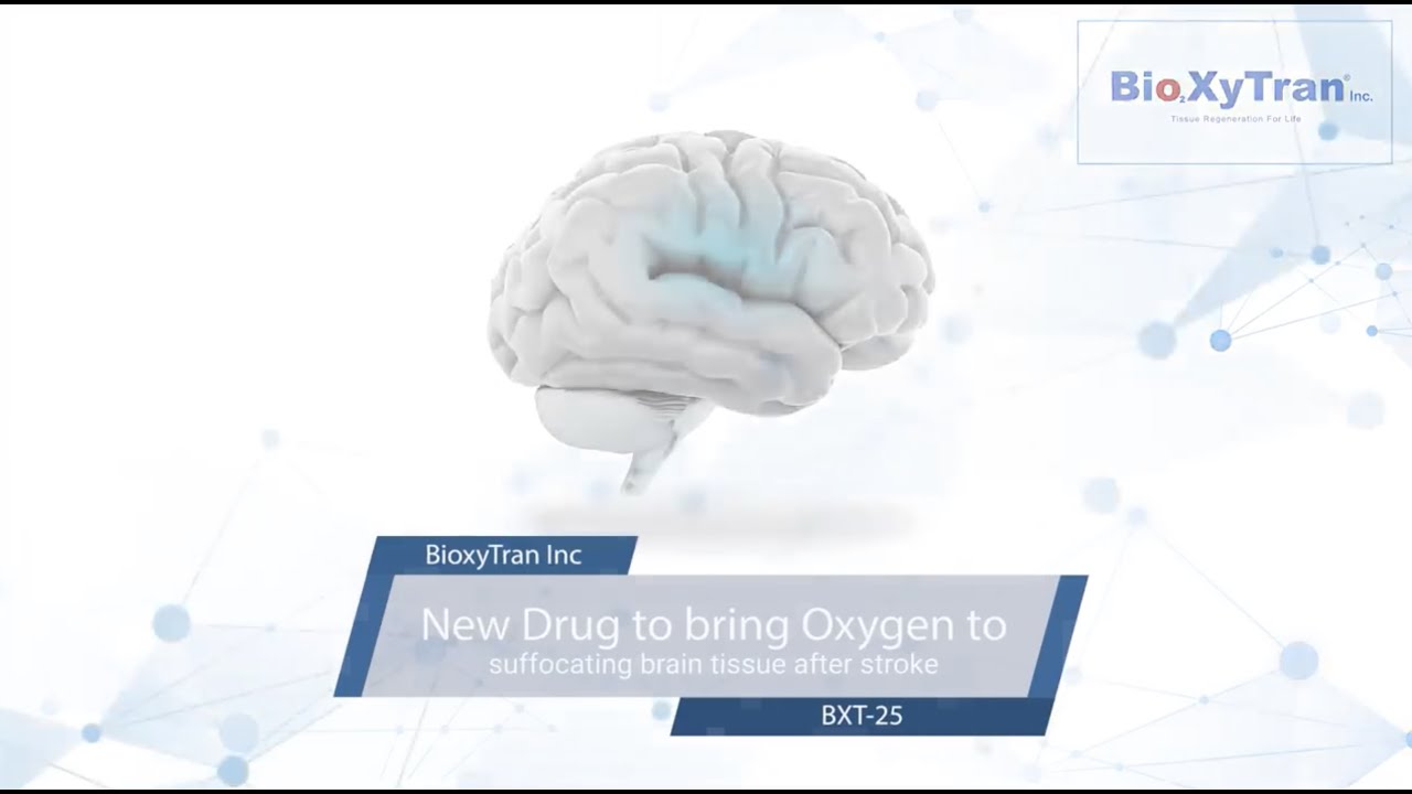 New BioXyTran ($BIXT) Drug-in-Development to Bring Oxygen to Suffocating Brain Tissue After Stroke