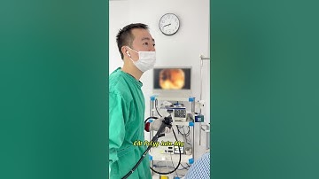 Nội soi can thiệp cắt đa Polyp đại tràng cho bệnh nhân