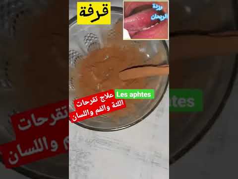 علاج سريع   وتقرحات الفم واللسان واللثة وردة الريحان