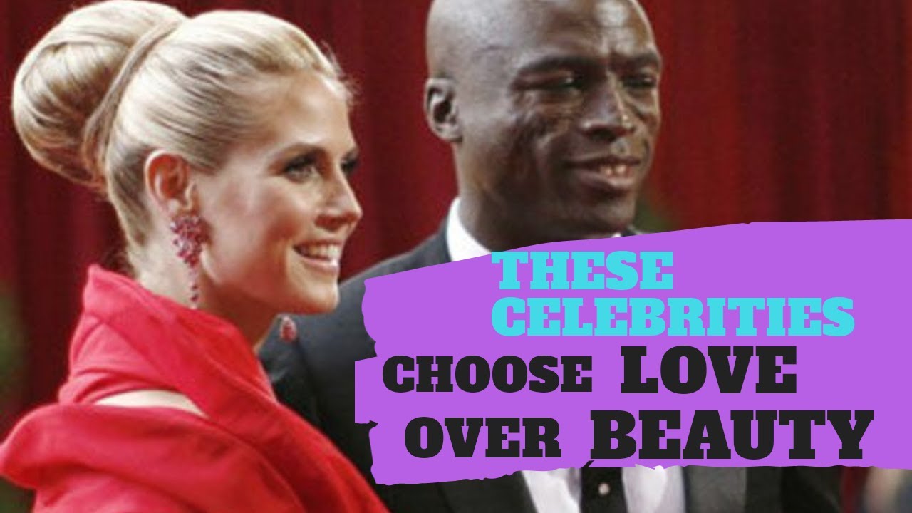 celebrities who chose love over beauty