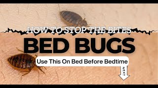 How To Stop Bed Bugs From Biting You At Night