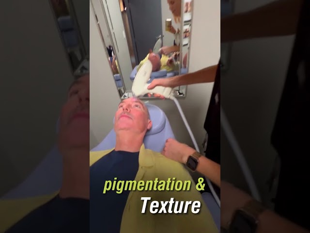 How Tixel Improves Wrinkles | Scars | and Skin Texture #wrinkletreatment #skintreatment #glowingskin