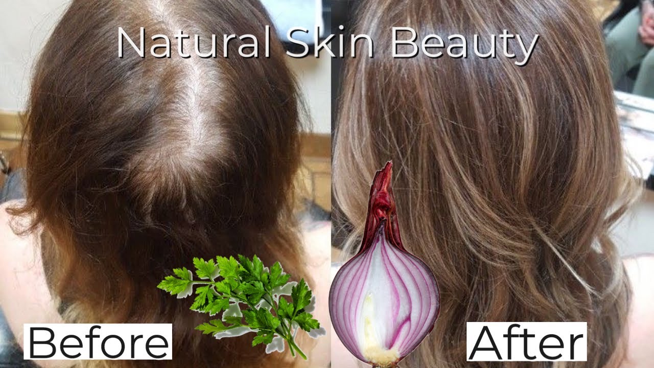 Your hair will grow 5 times faster Get rid of baldness quickly, A final