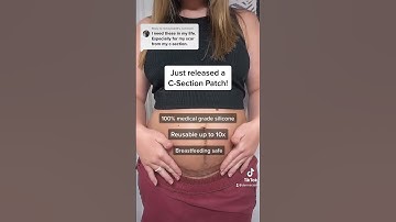 C-Section Patch to heal scars 🫶 #csection #scar