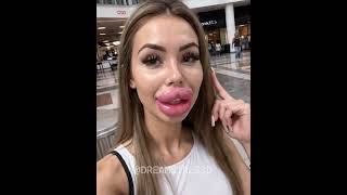 Proof that perfection is a process. 💉