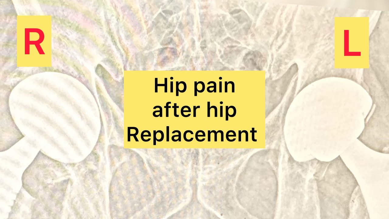 Hip Replacement Pain