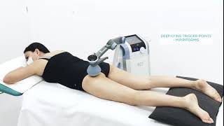 Deep-lying Trigger Points with BTL Focused Shockwave - Static