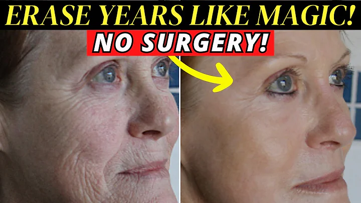 The INCREDIBLE benefits of chemical peels for anti-aging!