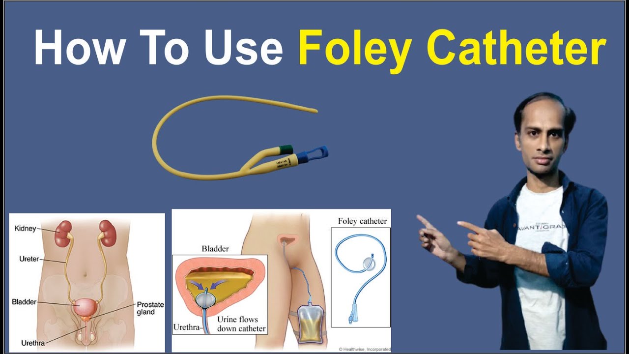 Foley Catheter Foley Catheter And Drainage Bag Care How Long To Use 