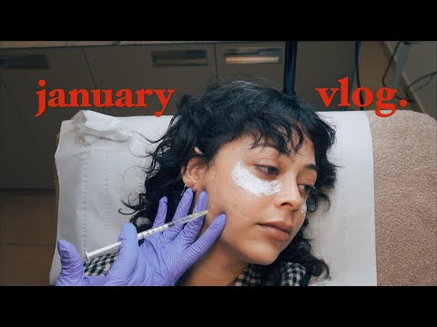 january vlog, girl dinner & botox