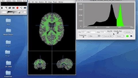 Histogram Options, Interacting with the Histogram