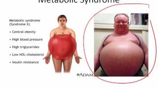 Diabetes Basics - Dr. Bowe