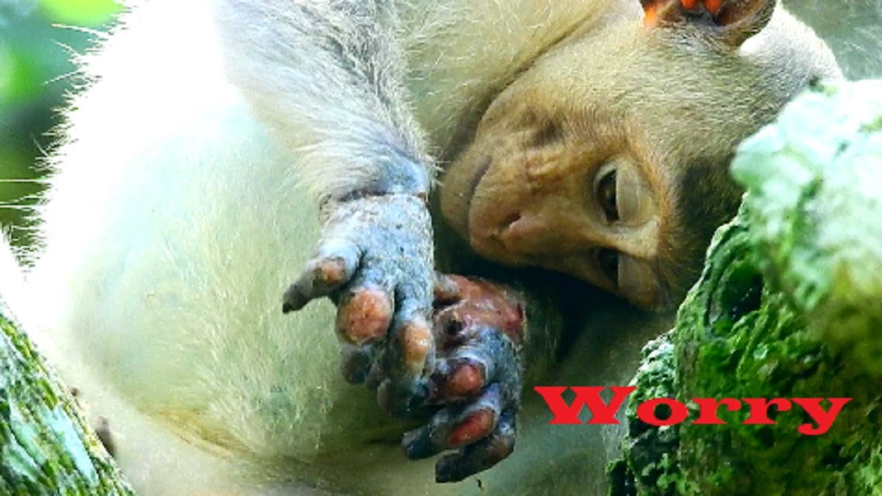 Poor Janet so sadness cos pity on fingers, Tasana try comfort & hug little girl, Run with 2 legs