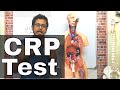 CRP test procedure in Hindi