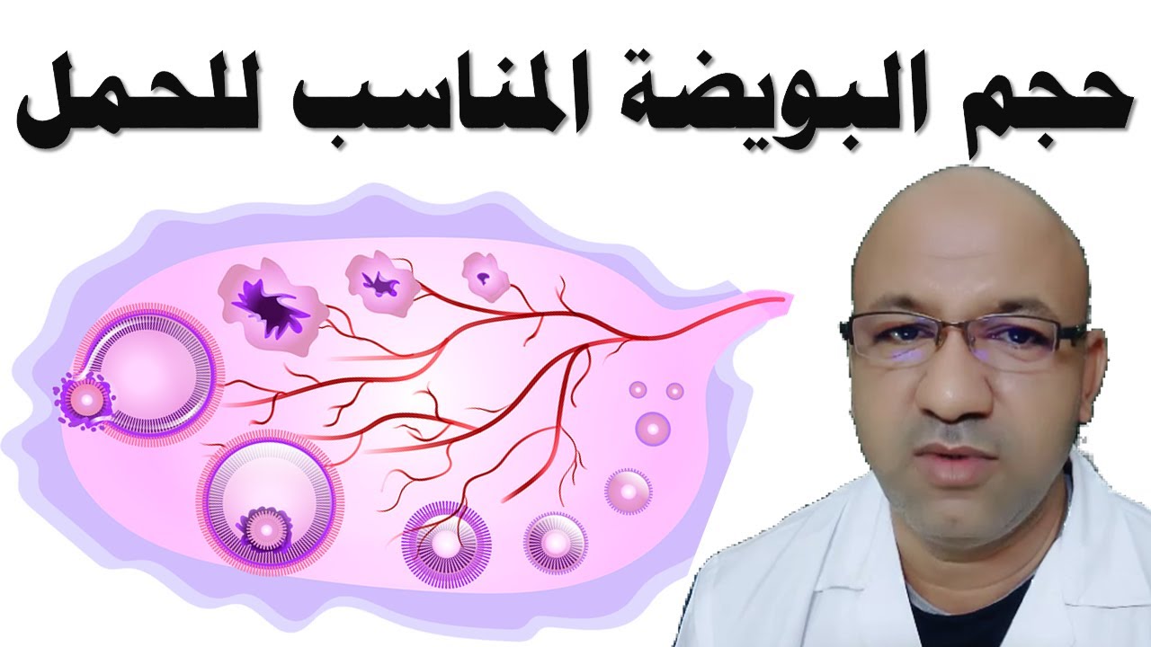 حجم البويضة المناسب للحمل أيام التبويض وتاخر الحمل دكتور يوسف عيد DR YUSSIF EID 2021