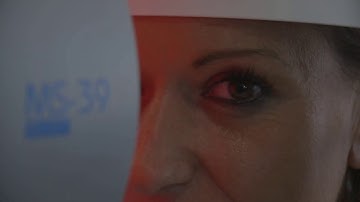 CSO, ANTERIOR OCT, MS-39