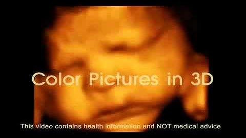 4D Ultrasound in New York by 1st Glimpse Inc. 3D/4D Ultrasound