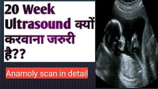 20 Week Ultrasound in pregnancy|20 week ultrasound in detail| Anamoly scan at 20 weeks