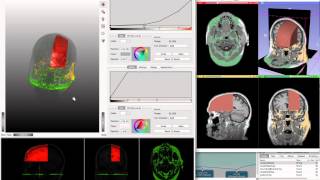 Slicer MeVisLab TagVolumeRendering 2012 09 26