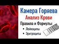 КАМЕРА ГОРЯЕВА | Как проводить Анализ Крови | Правила и Формулы подсчёта Лейкоцитов и Эритроцитов