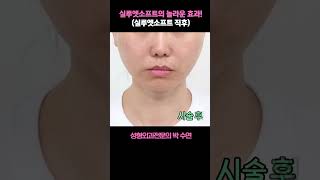 실루엣 소프트의 놀라운 효과!? #실루엣소프 #실리프팅#박수연원장