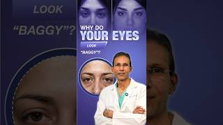 what is baggy eye lift