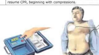 HS CPR AED