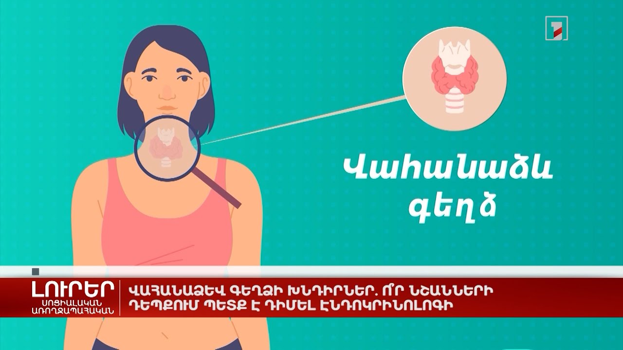 Վահանաձև գեղձի խնդիրներ. ո՞ր նշանների դեպքում պետք է դիմել էնդոկրինոլոգի