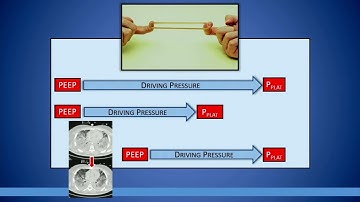 The Fundamentals of Mechanical Ventilation and Its use While on ECMO