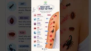 Insect Bites Explained 🦟 How to Identify Common Bug Bites