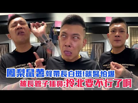 鳳梨鼠薯聲帶長白斑！就醫怕爆　被長管子插鼻：拎北要不行了啊